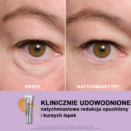 🌸Natychmiastowy Liftingujący Krem pod Oczy o Lekkiej Konsystencji – Maksymalne Ujędrnienie i Gładkie Wykończenie ✨